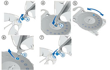 Maintenance of an HF-4 hearing aid prosthesis(Sivantos)